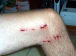 crocodile attack at cape tribulation